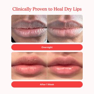 LipSoftie® Lip Treatment Trio