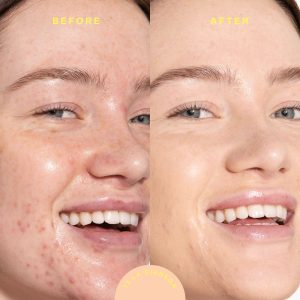 SunnyDays™ Tinted SPF 30